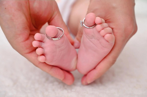 孝昌孕妇怎样预防妊娠纹